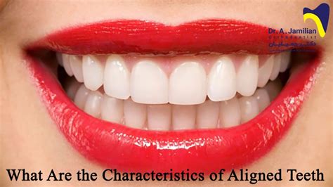 What are the characteristics of aligned teeth? - Dr Jamilian