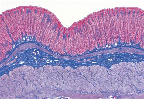 Johannes Lieder Beginner's Human Tissue Slides, Set of 15