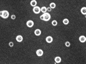 Cryptococcus neoformans - microbewiki