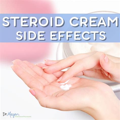 Steroid Cream Side Effects | Dr. Megan