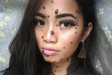 This Miss Universe Malaysia Contestant Was Born With Moles All Over Her ...