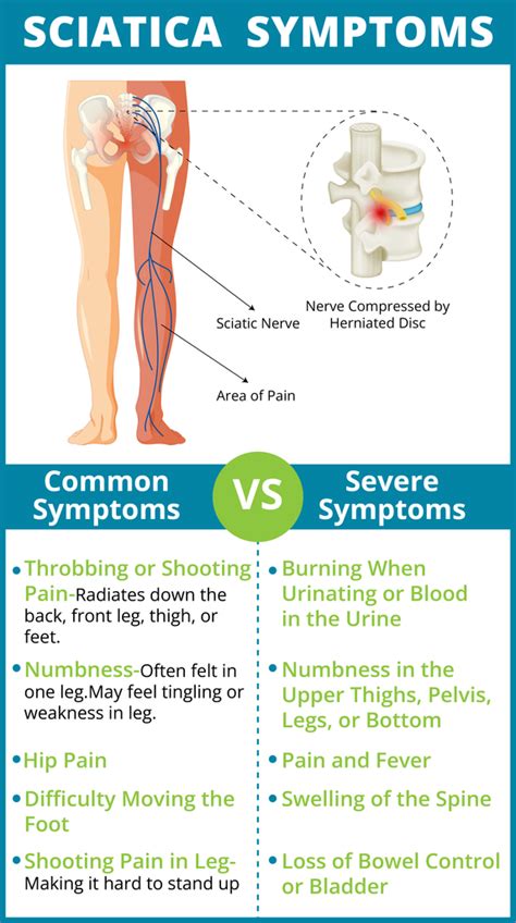 What Are Sciatica Symptoms? Helpful Guide to Tell If It Sciatica - Easy ...