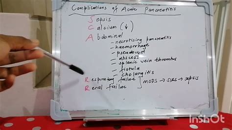 Mnemonic 54 : Complications of Acute Pancreatitis - YouTube