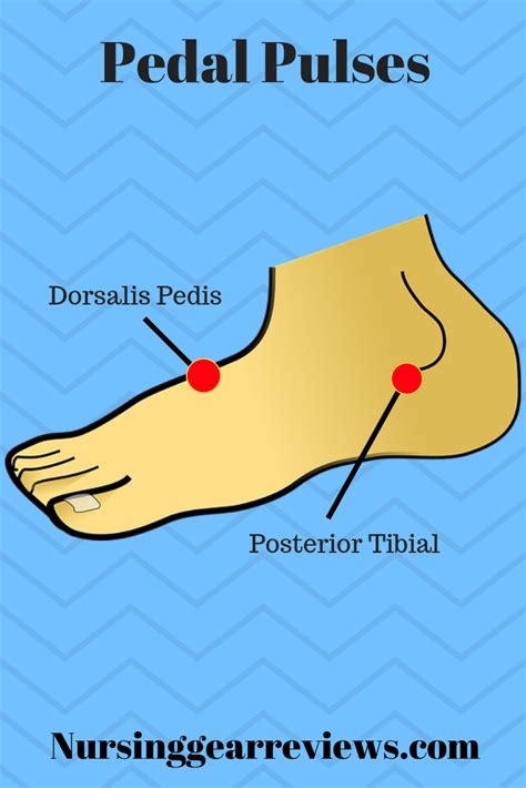 Pedal Pulses | Health assessment nursing, Nurse, Nursing study