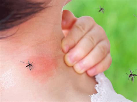 How to know if you’ve been bitten by a dengue mosquito: 5 facts about ...