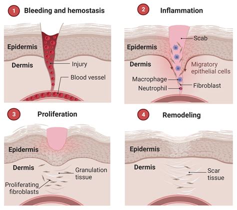 Stages of the wound healing cascade. Created by using BioRender.com ...