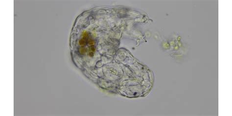 Tardigrade Microscope