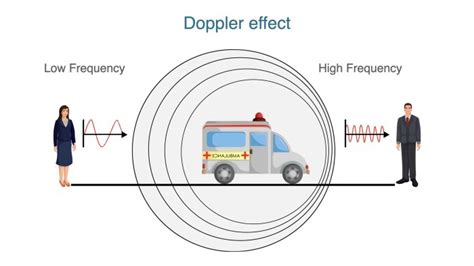 Ultrasound 101 – Part 10: Color Doppler | 123sonography