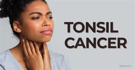 Tonsil Cancer | Causes | Symptoms | Diagnosis | Treatment