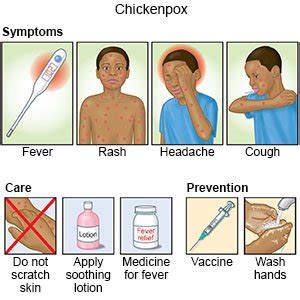 Chicken Pox Symptoms In Adults – Telegraph