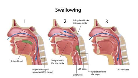 Tonsil Cancer Staging