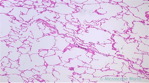 Microscope World Blog: Human Lungs under the Microscope