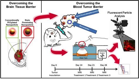 Price Lab | Chemotherapy Delivery to Brain Tumors with Focused Ultrasound