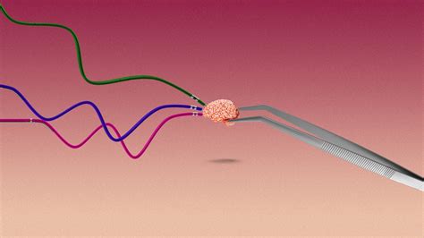 Mini caps can measure activity in lab-grown minibrains | MIT Technology ...