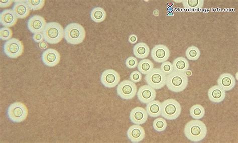 Cryptococcus Neoformans - Habitat, Epidemiology, Treatment + More