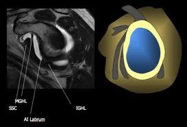 MRI Musculo-Skeletal Section: Glenohumeral ligaments