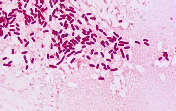 Enterobacter Aerogenes Gram Stain