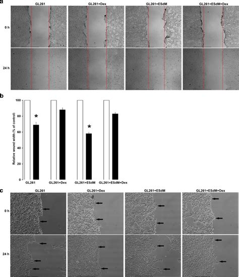 Wound healing assay in GL261 cells grown in monocultures or co-cultures ...