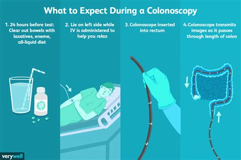 Colonoscopy: Overview