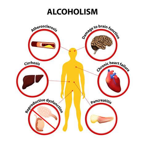 Effects of Alcohol on the Body - Quit Alcohol