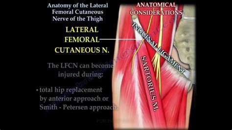 Anatomy Lateral Femoral Cutaneous Nerve Of Thigh - Everything You Need ...