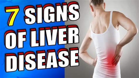 What Are The Early Signs of Liver Disease? | 7 SYMPTOMS You Should Know ...