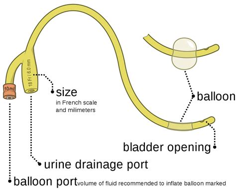 Urinary catheter, types of urinary catheter & urinary catheter ...