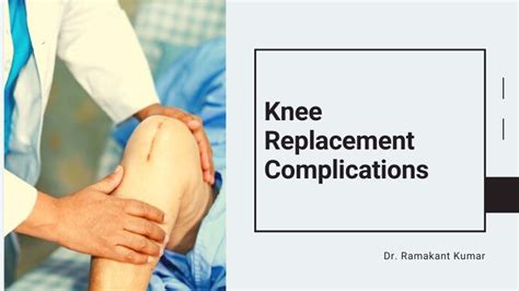 Knee Replacement Complications | Signs of Knee Replacement Failure