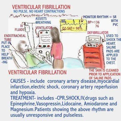 1000+ images about NURSE on Pinterest | Nursing process, Pharmacology ...