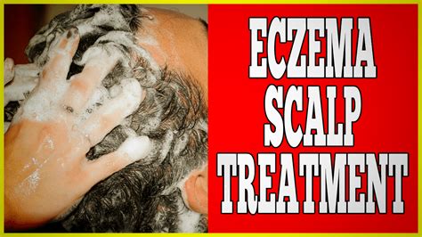 Eczema Scalp Treatment - Clinton Conley