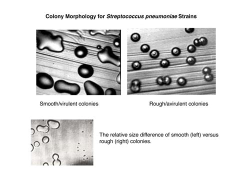 1 DNA structure and replication - Colony Morphology for Streptococcus ...