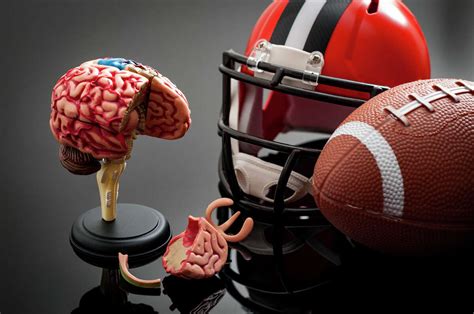 CTE found in 92% of NFL players' brains, Boston University study says