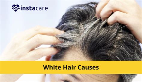 What are Causes Of White Hair And How To Prevent It?