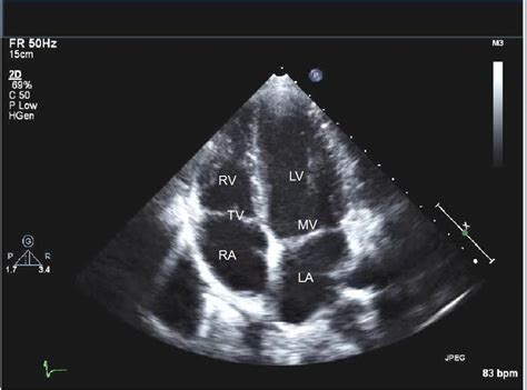 Pin on cardiac care