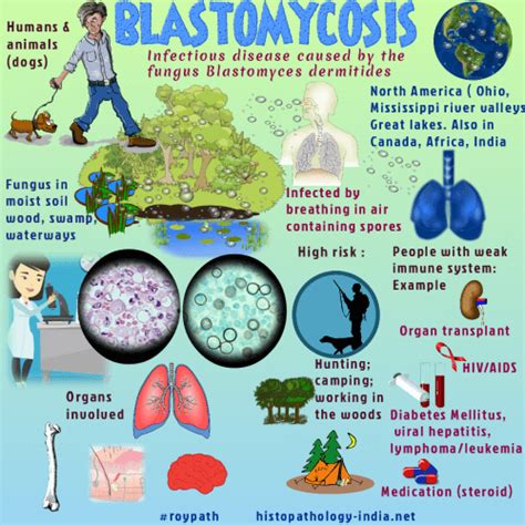 Pathology of Blastomycosis- Dr Sampurna Roy MD