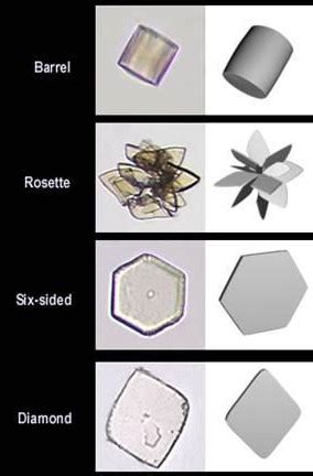 Variations of Uric acid crystals in urine | Medical Laboratories