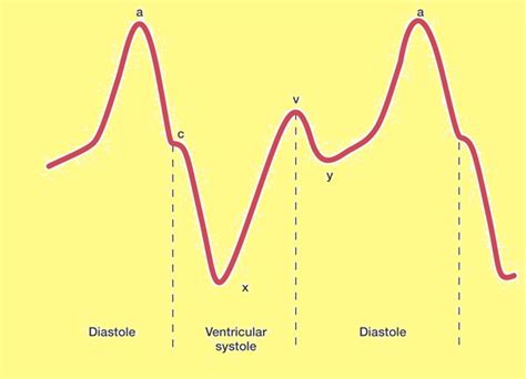 JVP (Jugular Venous Pulse)