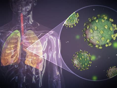 Understanding Lung Disease: Causes, Symptoms and Treatment Options