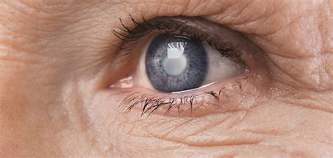 Macular Degeneration: 10 Symptoms of Macular Degeneration