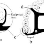 What is Circumferential Clasp, Types, its Disadvantages and Form ...