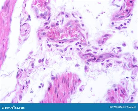 Picture of Histology Human Tissue with Microscope from Laboratory (not ...