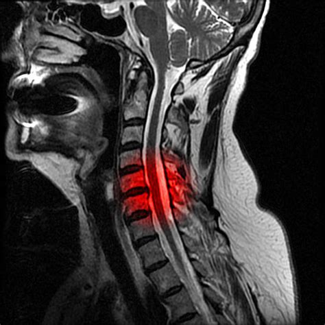 Neck And Jaw Mri Stock Photos, Pictures & Royalty-Free Images - iStock