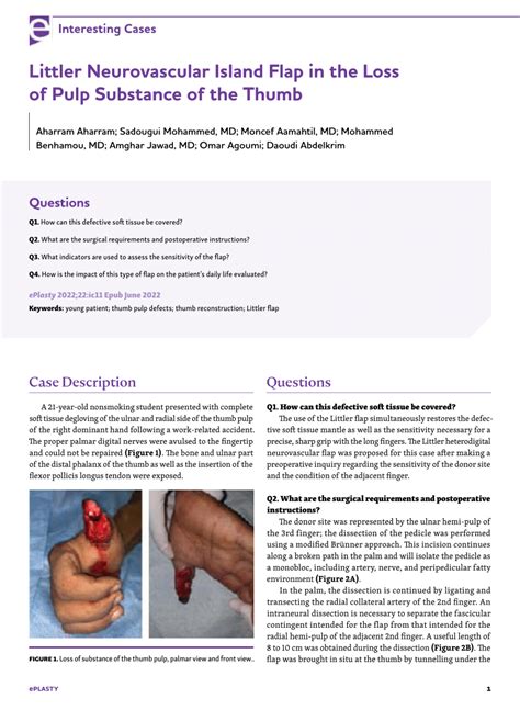 (PDF) Littler Neurovascular Island Flap in the Loss of Pulp Substance ...