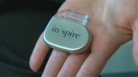 Highland Hospital offers 'Inspire' device to help sleep apnea patients ...