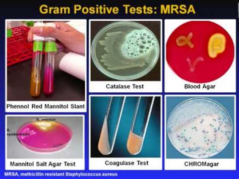 Introduction to Microbiology Culture Techniques - YouTube