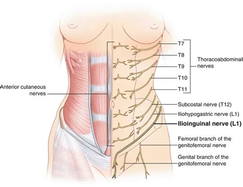 Ilioinguinal Nerve Entrapment - Cause, Symptoms, Treatment