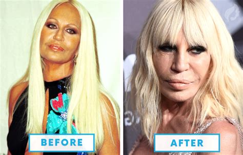 TOP 10 FAILED CELEBRITY PLASTIC SURGERIES – Viral Wow