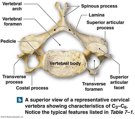 Major components of a typical vertebrae and the vertebral canal ...