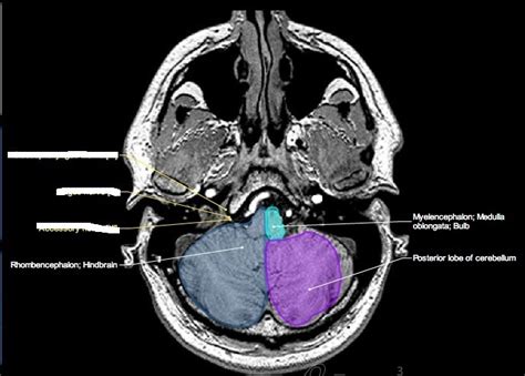 cranial 11 Diagram | Quizlet