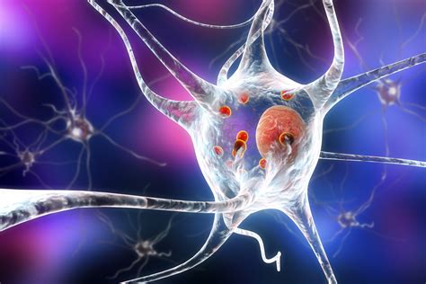 Study reveals roots of Parkinson’s disease in the brain - ellines.com